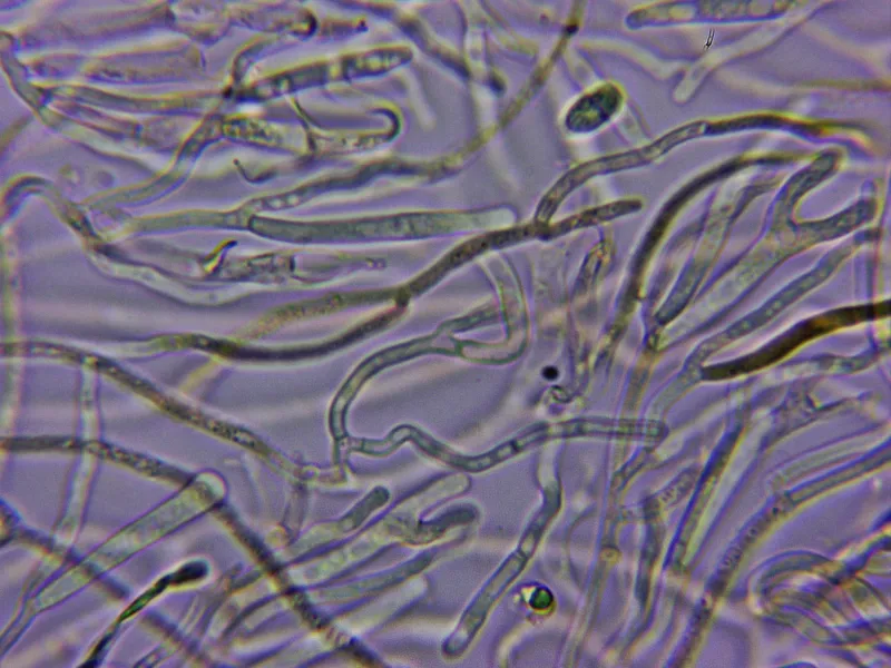 Calocera cornea 20 - Hifas sin fíbulas
